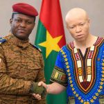 Burkina Faso : Claude Wilfried Ekanga, l’« albinos noir » tant attendu d’Ibrahim Traoré ?